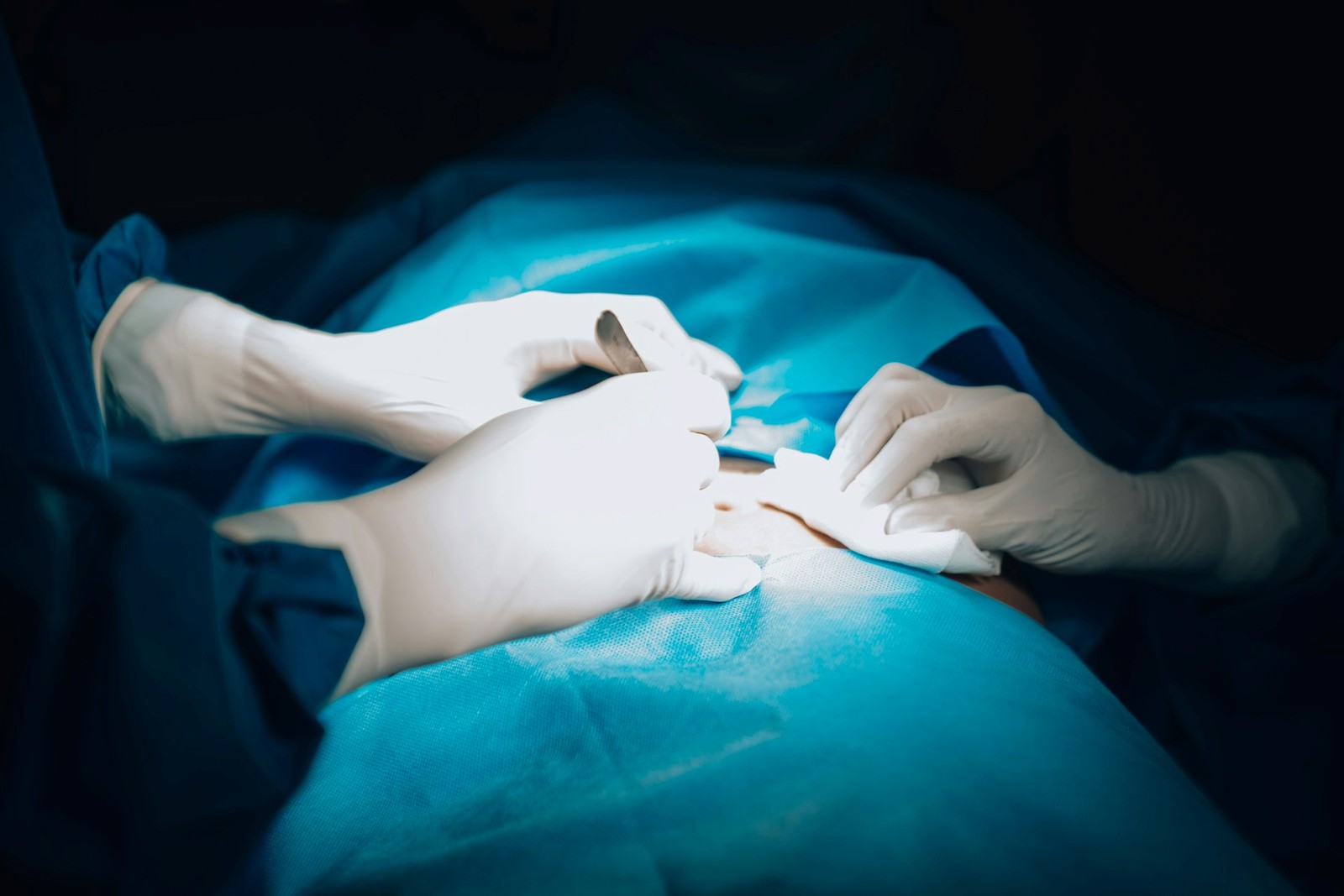 Non-Healing Surgical Wounds: When to See a Wound Specialist vs. Dermatologist