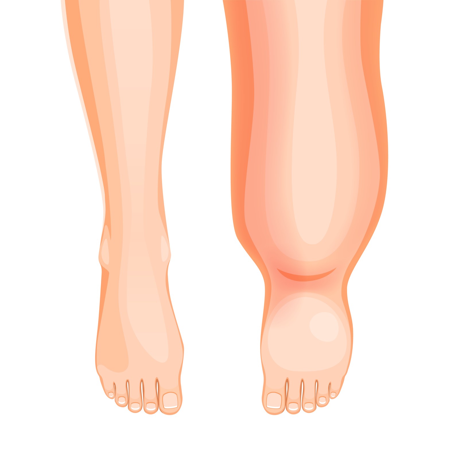 DFW Home Wound Care and Lymphedema: Room-by-Room Setup Guide