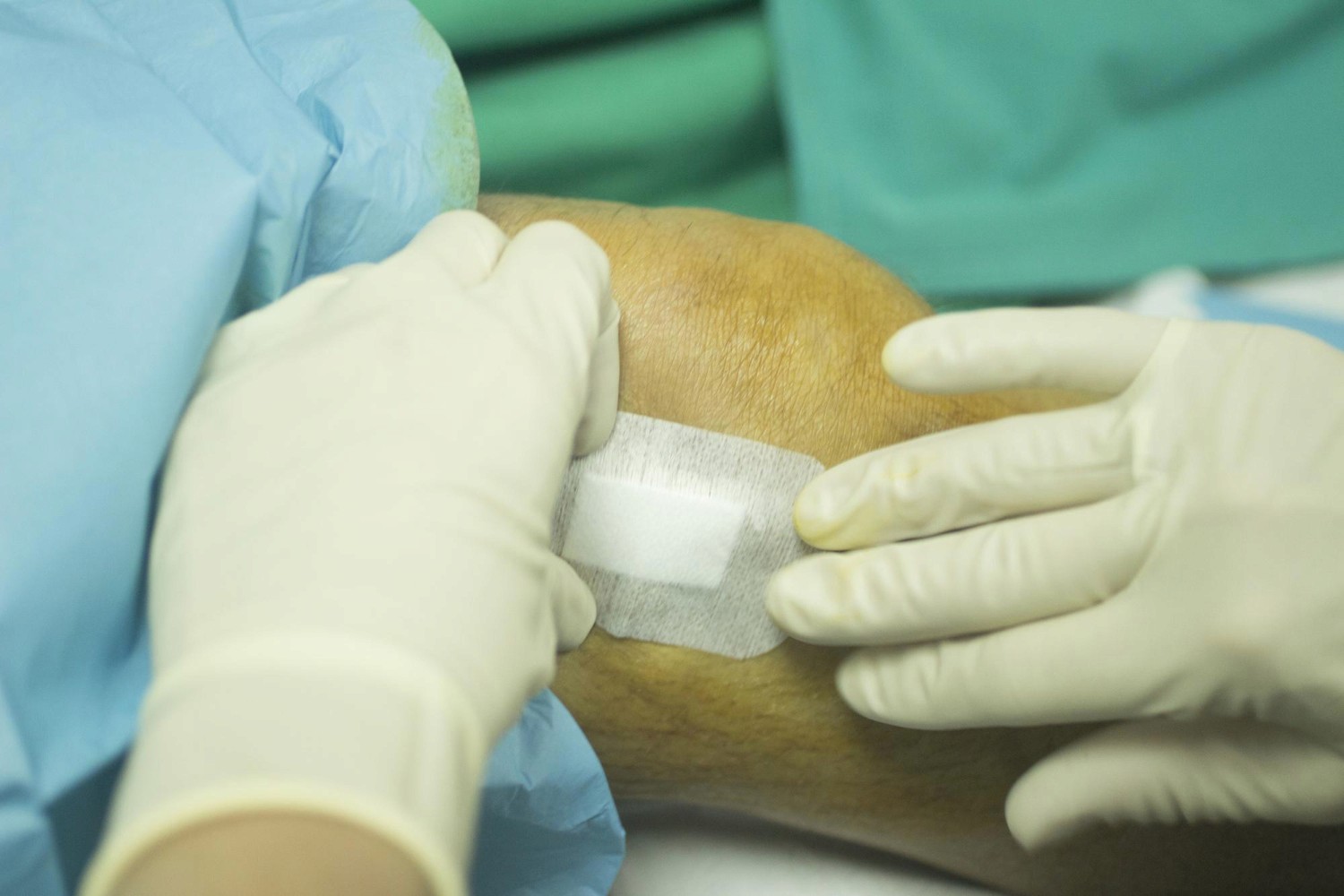 Deciding on Negative Pressure Wound Therapy at Home in Dallas