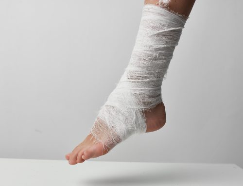 The Science Behind Allografts