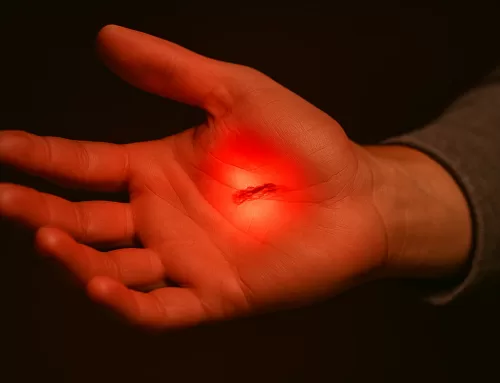 The Role of Red Light Therapy in Wound Care