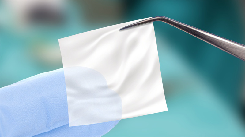 amniotictissuesurgery_1280 Cellular Tissue Allograft Therapy in Dallas